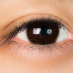 結膜下出血を繰り返す原因を特定するために、眼科医が目の状態を詳しく診察・検査している様子