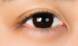 結膜下出血を繰り返す原因を特定するために、眼科医が目の状態を詳しく診察・検査している様子
