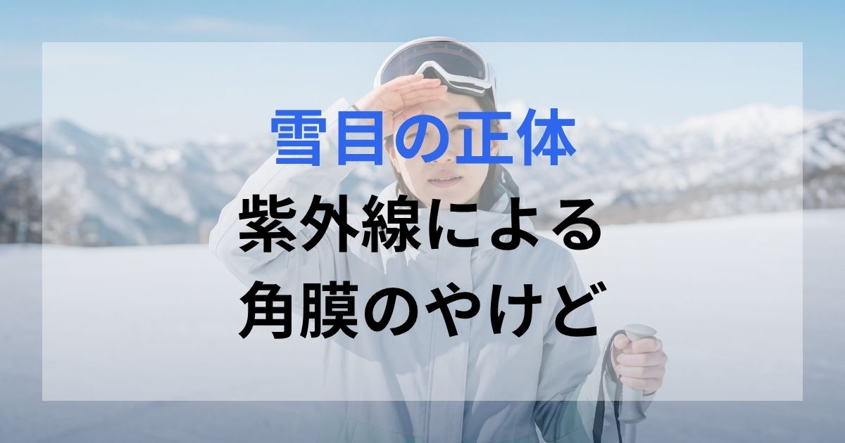スキー場のゲレンデでまぶしく目を気にしている女性。