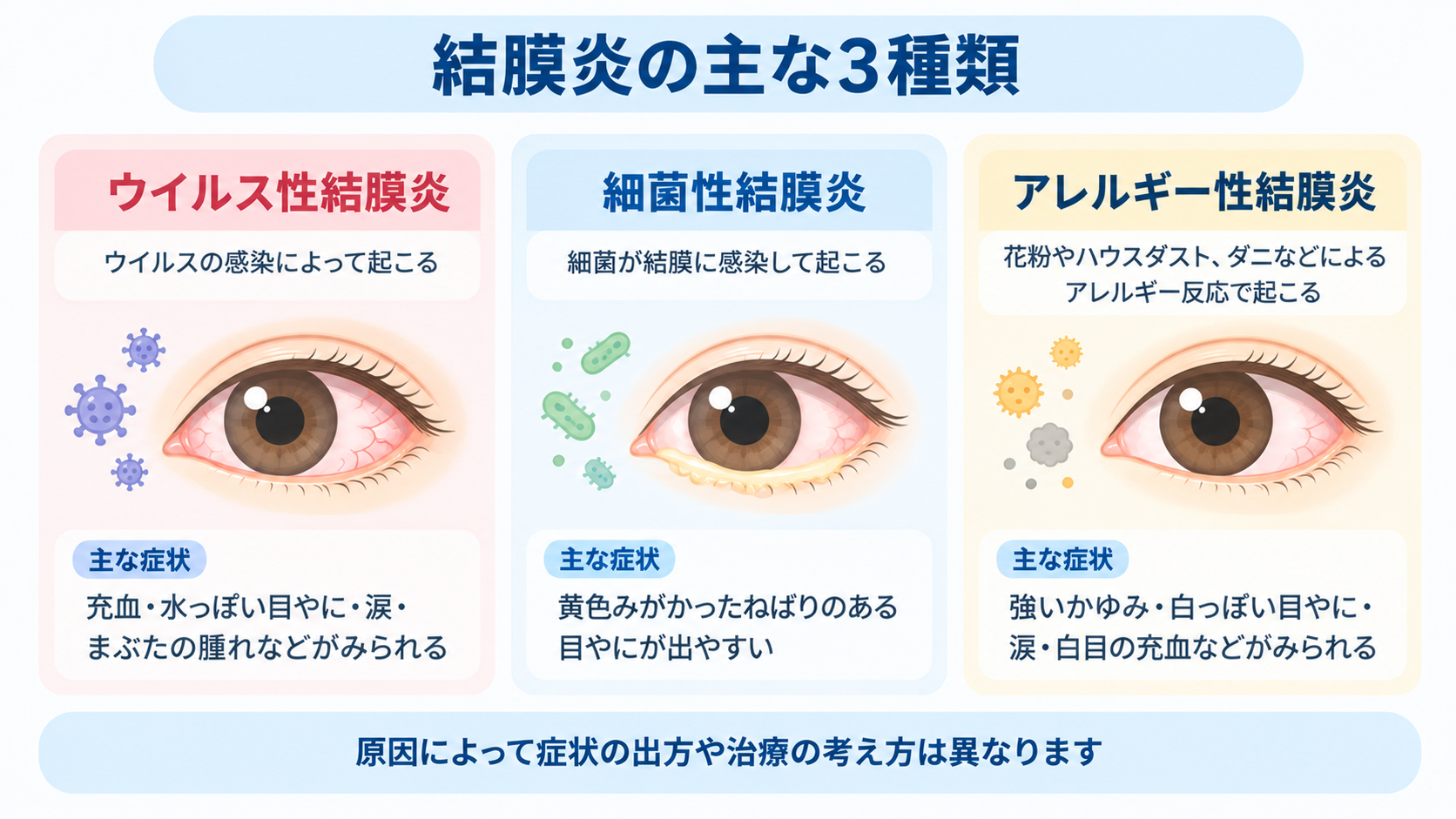 結膜炎の主な3種類
